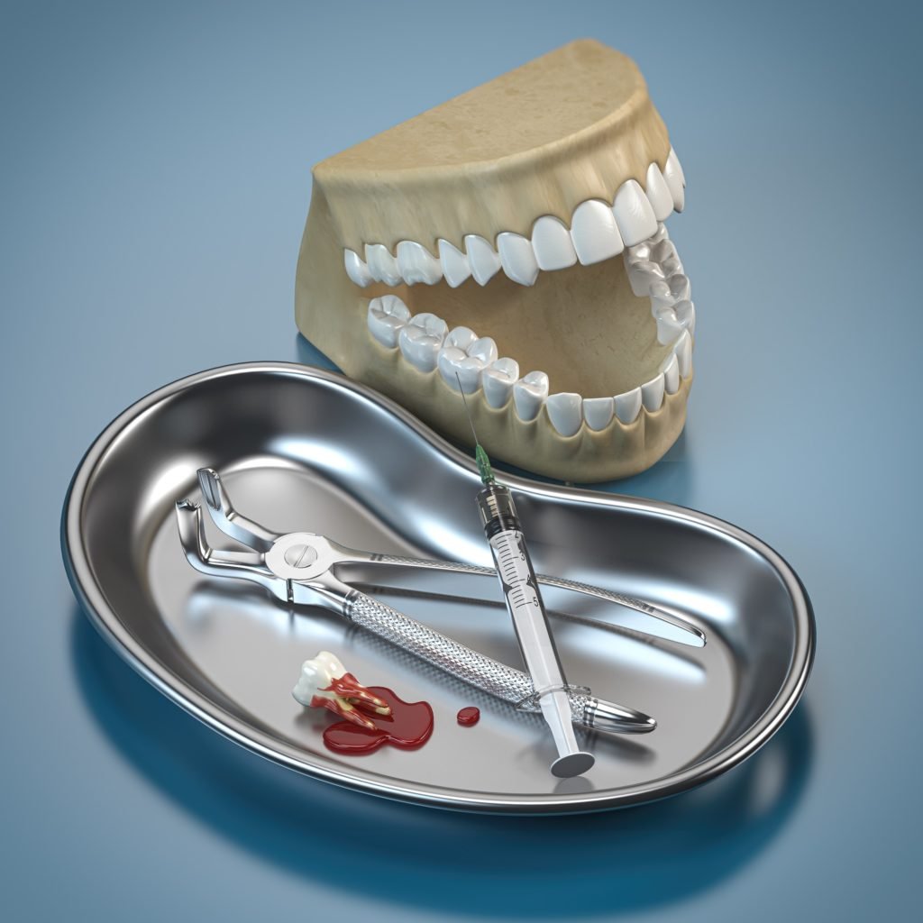 Dentist tools for dental care and human brace model.